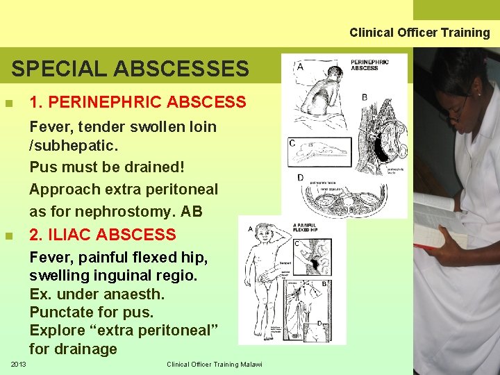 Clinical Officer Training SPECIAL ABSCESSES n 1. PERINEPHRIC ABSCESS Fever, tender swollen loin /subhepatic.