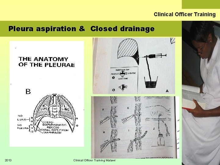 Clinical Officer Training Pleura aspiration & Closed drainage 2013 Clinical Officer Training Malawi 