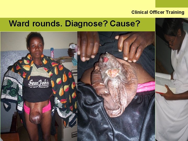 Clinical Officer Training Ward rounds. Diagnose? Cause? 