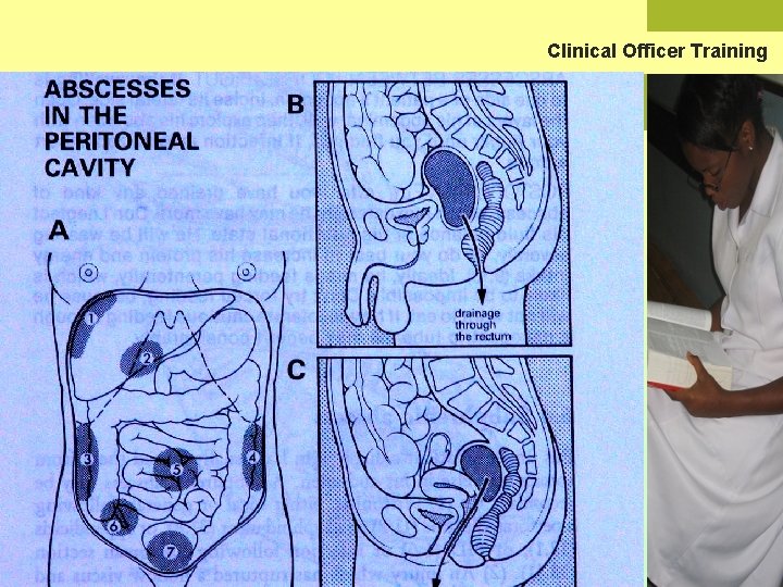 Clinical Officer Training 2005 Clinical Officer Training Malawi 