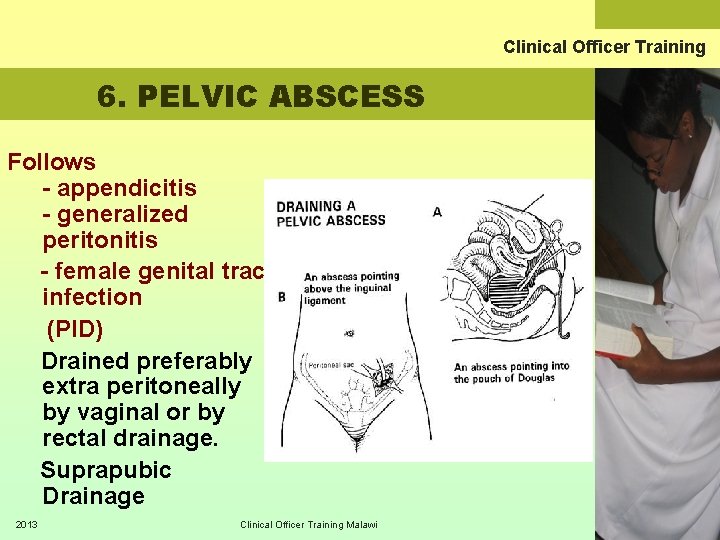 Clinical Officer Training 6. PELVIC ABSCESS Follows - appendicitis - generalized peritonitis - female