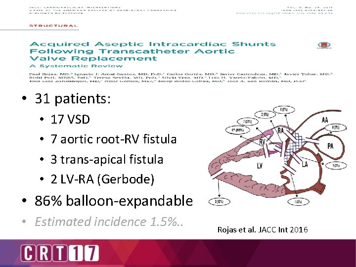  • 31 patients: • • 17 VSD 7 aortic root-RV fistula 3 trans-apical