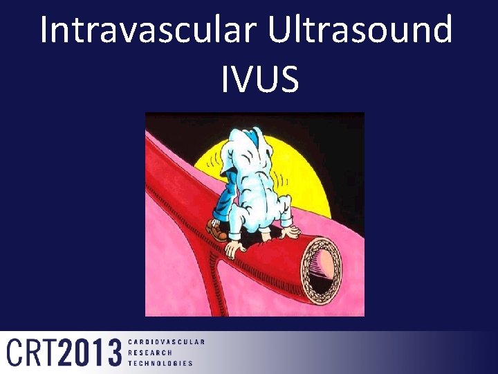 Intravascular Ultrasound IVUS 