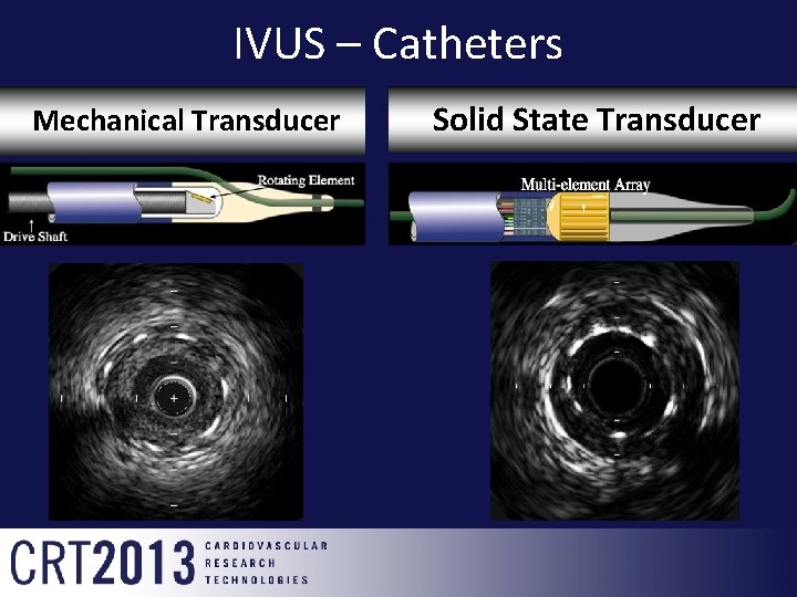 IVUS – Catheters Mechanical Transducer Solid State Transducer 