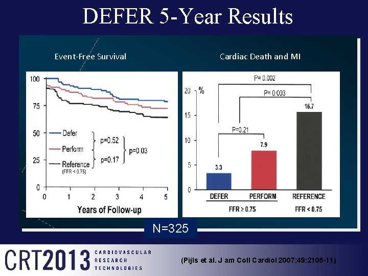 DEFER 5 -Year Results Event-Free Survival Cardiac Death and MI N=325 (Pijls et al.