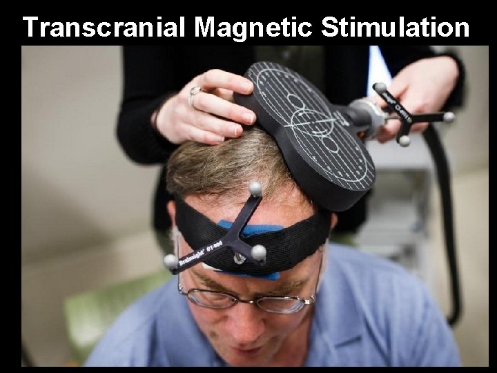 Transcranial Magnetic Stimulation 