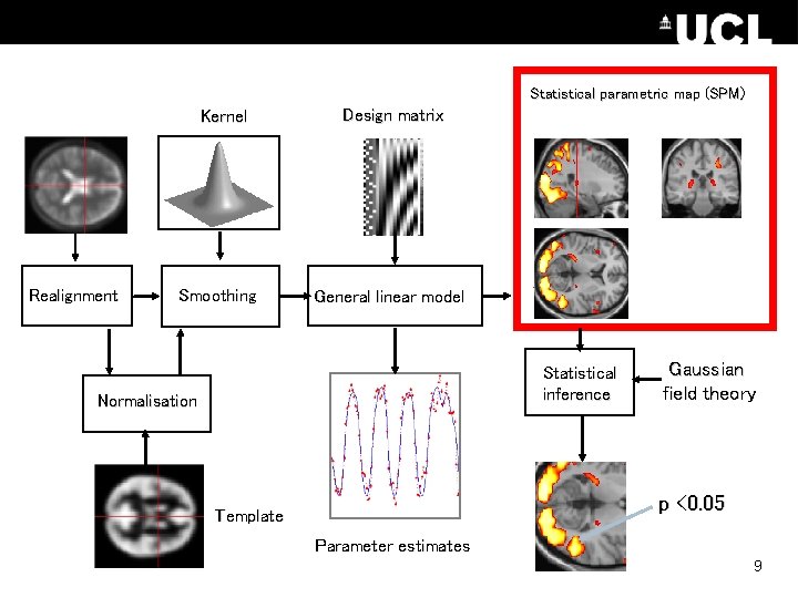 Statistical parametric map (SPM) Kernel Realignment Smoothing Design matrix General linear model Statistical inference Statistical parametric map (SPM) Kernel Realignment Smoothing Design matrix General linear model Statistical inference