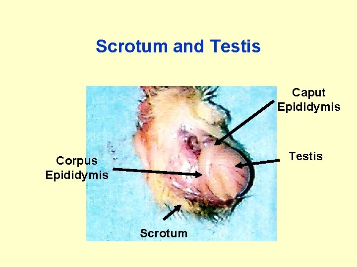 Scrotum and Testis Caput Epididymis Testis Corpus Epididymis Scrotum 