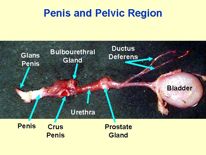Penis and Pelvic Region Glans Penis Bulbourethral Gland Ductus Deferens Bladder Urethra Penis Crus