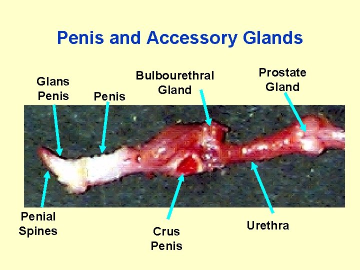 Penis and Accessory Glands Glans Penial Spines Penis Bulbourethral Gland Crus Penis Prostate Gland