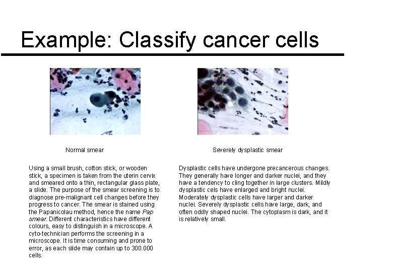 Example: Classify cancer cells Normal smear Using a small brush, cotton stick, or wooden Example: Classify cancer cells Normal smear Using a small brush, cotton stick, or wooden