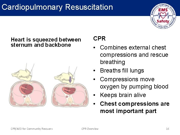 Cardiopulmonary Resuscitation Heart is squeezed between sternum and backbone CPR/AED for Community Rescuers CPR