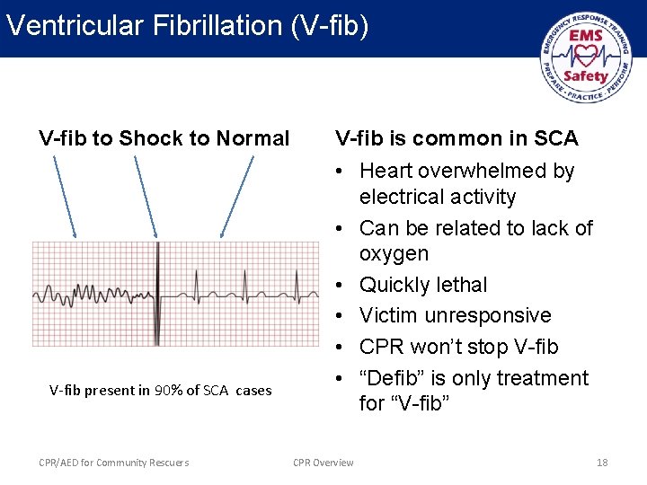 Ventricular Fibrillation (V-fib) V-fib to Shock to Normal V-fib present in 90% of SCA