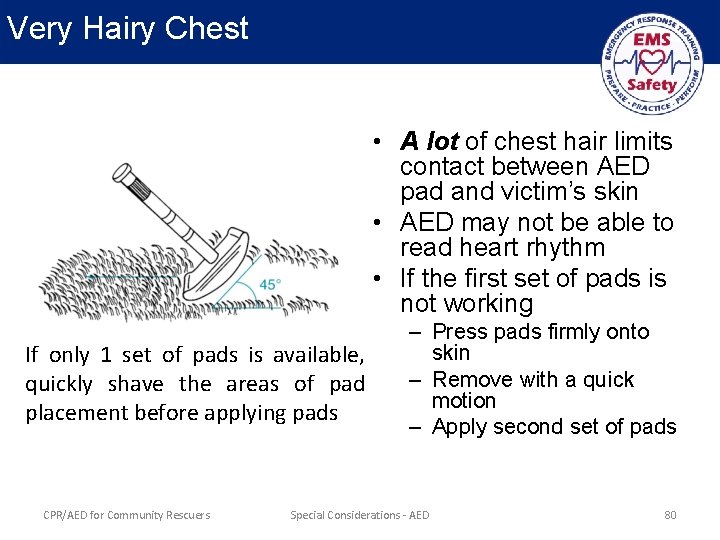 Very Hairy Chest • A lot of chest hair limits contact between AED pad