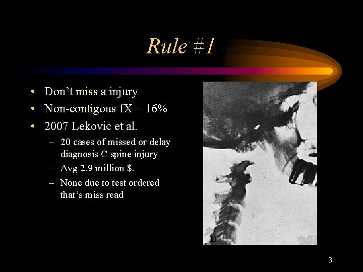 Rule #1 • Don’t miss a injury • Non-contigous f. X = 16% •