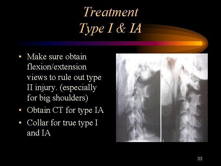 Treatment Type I & IA • Make sure obtain flexion/extension views to rule out