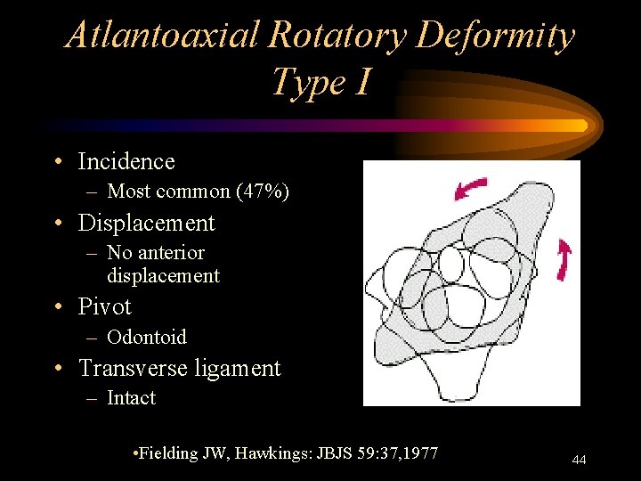 Atlantoaxial Rotatory Deformity Type I • Incidence – Most common (47%) • Displacement –