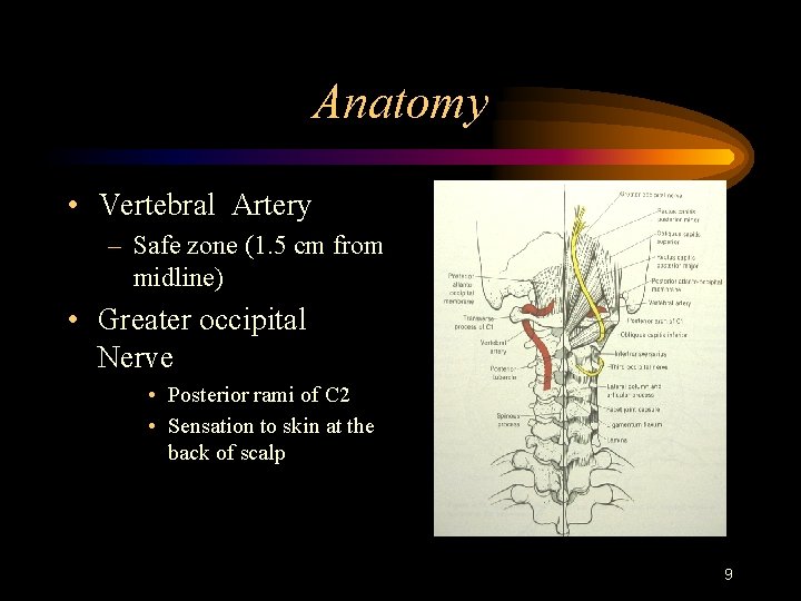 Anatomy • Vertebral Artery – Safe zone (1. 5 cm from midline) • Greater