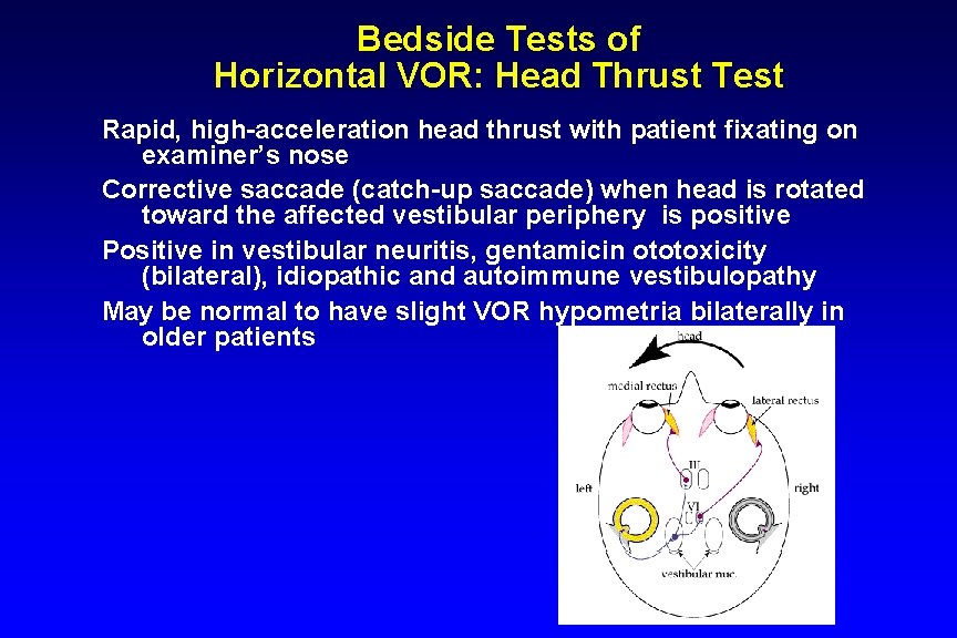 Bedside Tests of Horizontal VOR: Head Thrust Test Rapid, high-acceleration head thrust with patient