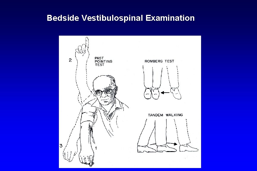 Bedside Vestibulospinal Examination 