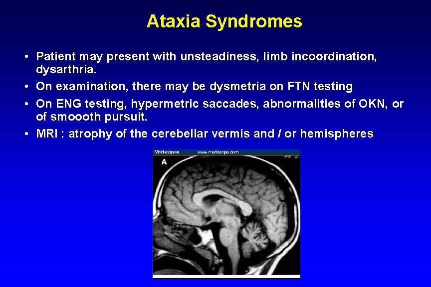 Ataxia Syndromes • Patient may present with unsteadiness, limb incoordination, dysarthria. • On examination,