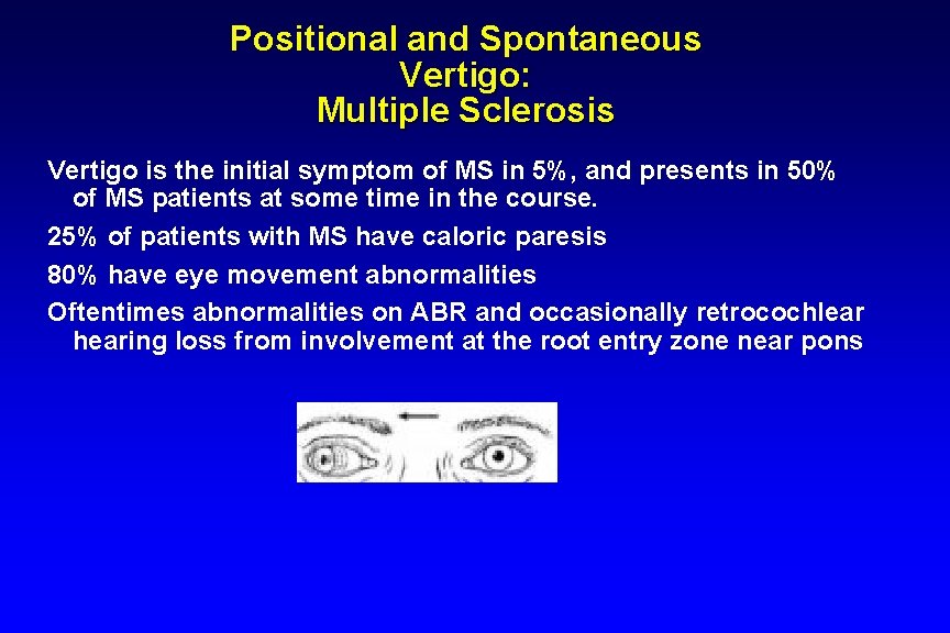 Positional and Spontaneous Vertigo: Multiple Sclerosis Vertigo is the initial symptom of MS in