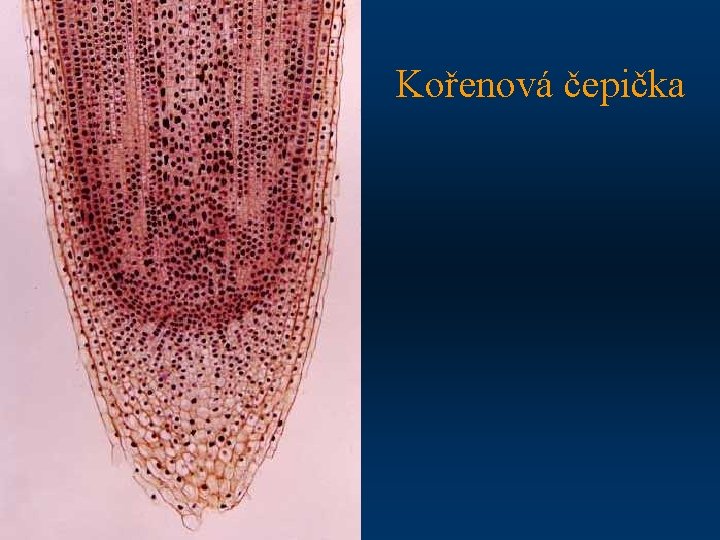 Kořenová čepička 