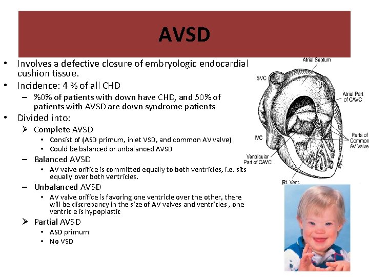 AVSD • Involves a defective closure of embryologic endocardial cushion tissue. • Incidence: 4