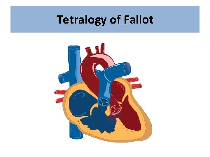 Tetralogy of Fallot 
