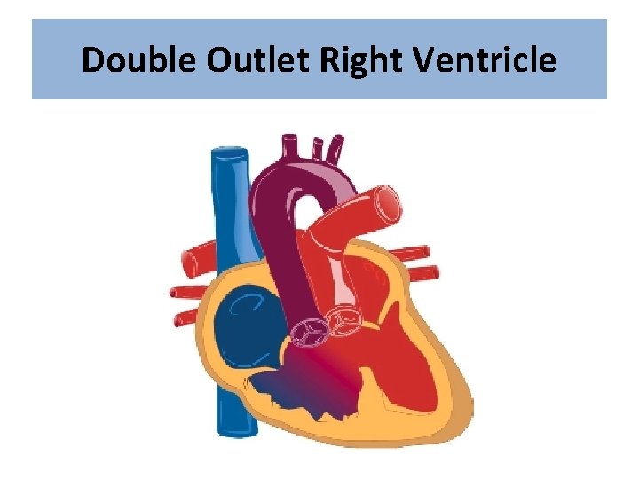 Double Outlet Right Ventricle 