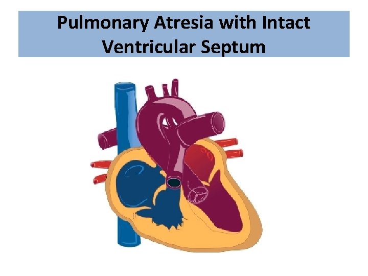 Pulmonary Atresia with Intact Ventricular Septum 