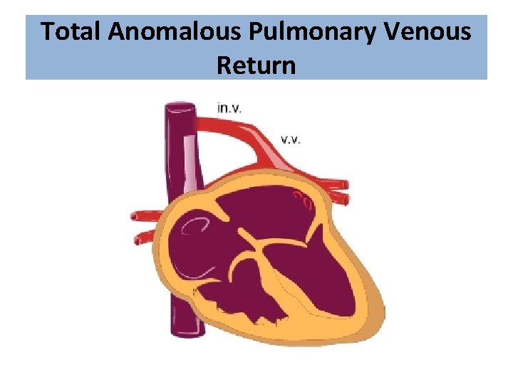 Total Anomalous Pulmonary Venous Return 