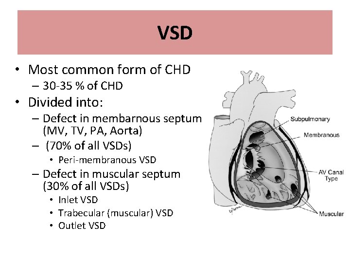 VSD • Most common form of CHD – 30 -35 % of CHD •