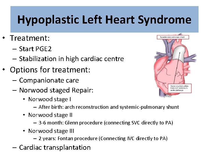 Hypoplastic Left Heart Syndrome • Treatment: – Start PGE 2 – Stabilization in high
