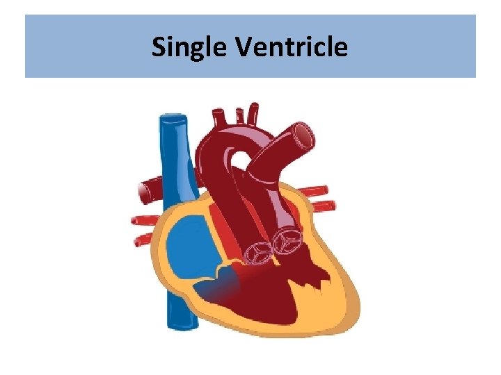 Single Ventricle 