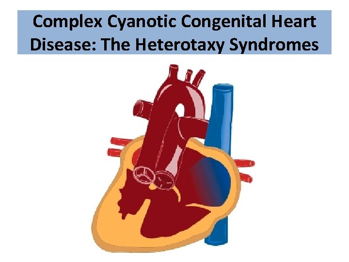 Complex Cyanotic Congenital Heart Disease: The Heterotaxy Syndromes 