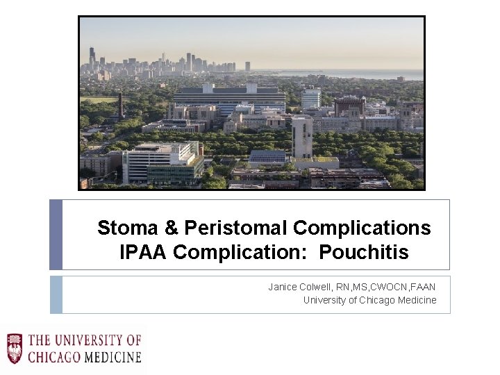 Stoma & Peristomal Complications IPAA Complication: Pouchitis Janice Colwell, RN, MS, CWOCN, FAAN University