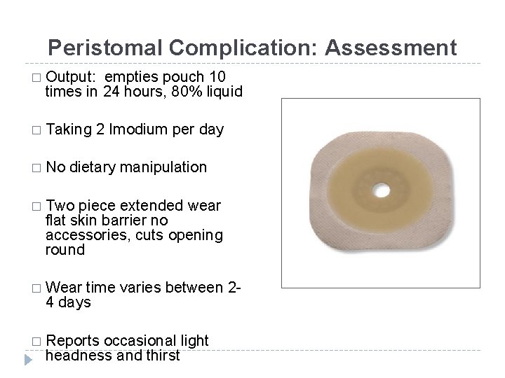 Peristomal Complication: Assessment � Output: empties pouch 10 times in 24 hours, 80% liquid