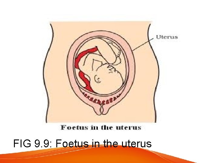 FIG 9. 9: Foetus in the uterus 