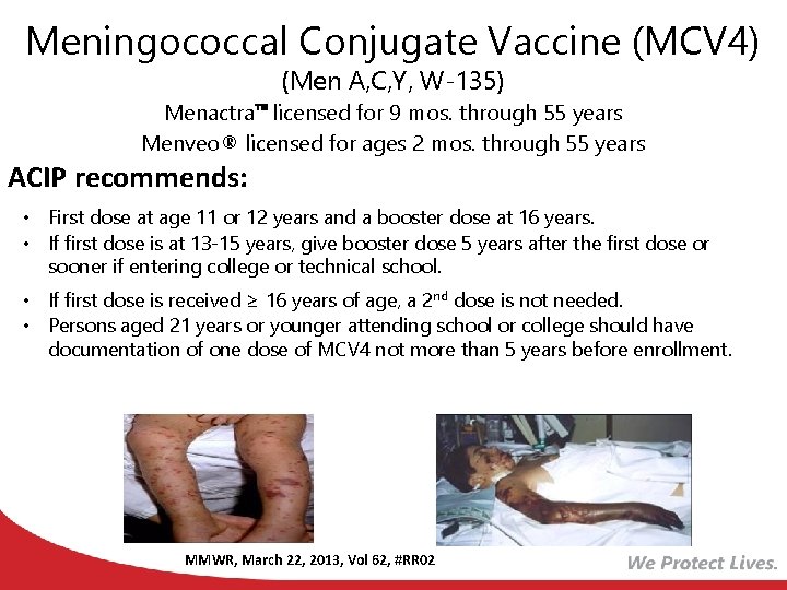 Meningococcal Conjugate Vaccine (MCV 4) (Men A, C, Y, W-135) Menactra licensed for 9