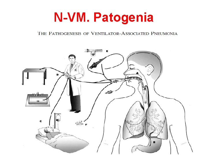 N-VM. Patogenia 