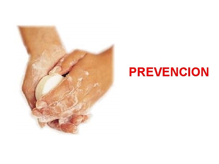 PREVENCION 