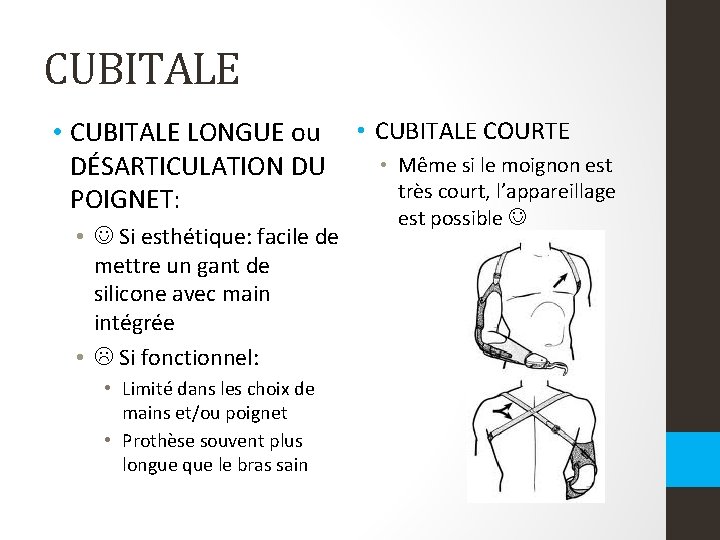 CUBITALE • CUBITALE LONGUE ou DÉSARTICULATION DU POIGNET: • Si esthétique: facile de mettre CUBITALE • CUBITALE LONGUE ou DÉSARTICULATION DU POIGNET: • Si esthétique: facile de mettre