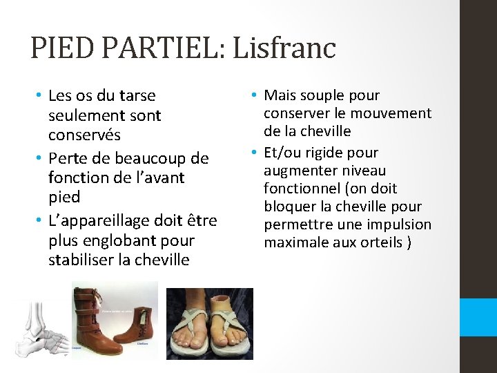 PIED PARTIEL: Lisfranc • Les os du tarse seulement sont conservés • Perte de PIED PARTIEL: Lisfranc • Les os du tarse seulement sont conservés • Perte de