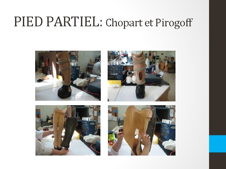 PIED PARTIEL: Chopart et Pirogoff PIED PARTIEL: Chopart et Pirogoff