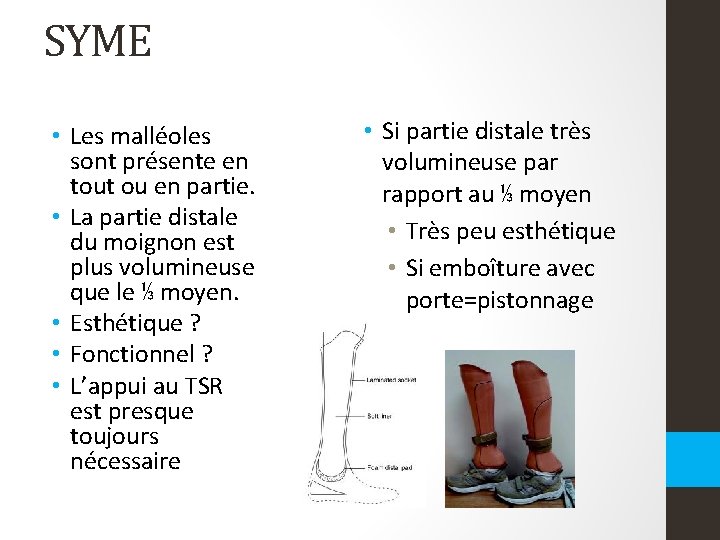 SYME • Les malléoles sont présente en tout ou en partie. • La partie SYME • Les malléoles sont présente en tout ou en partie. • La partie