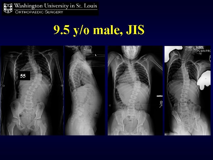 9. 5 y/o male, JIS 5555 