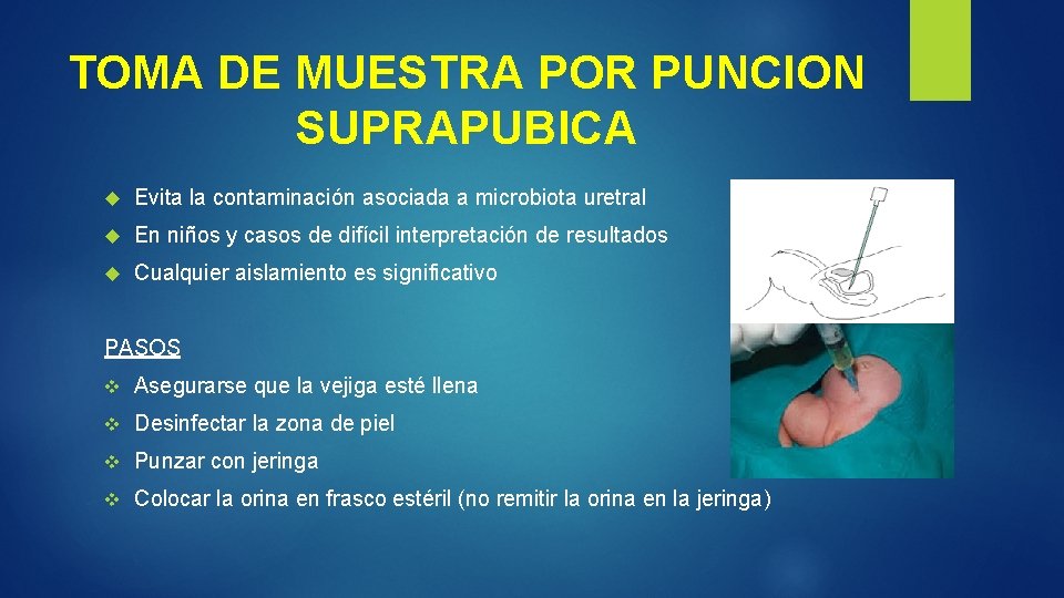 TOMA DE MUESTRA POR PUNCION SUPRAPUBICA Evita la contaminación asociada a microbiota uretral En