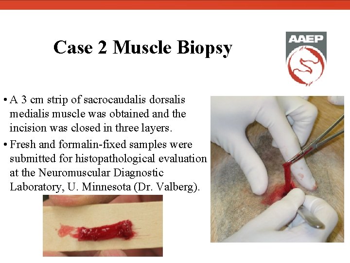  Case 2 Muscle Biopsy • A 3 cm strip of sacrocaudalis dorsalis medialis