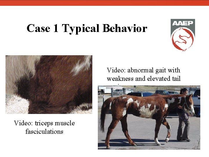  Case 1 Typical Behavior Video: triceps muscle fasciculations Video: abnormal gait with weakness